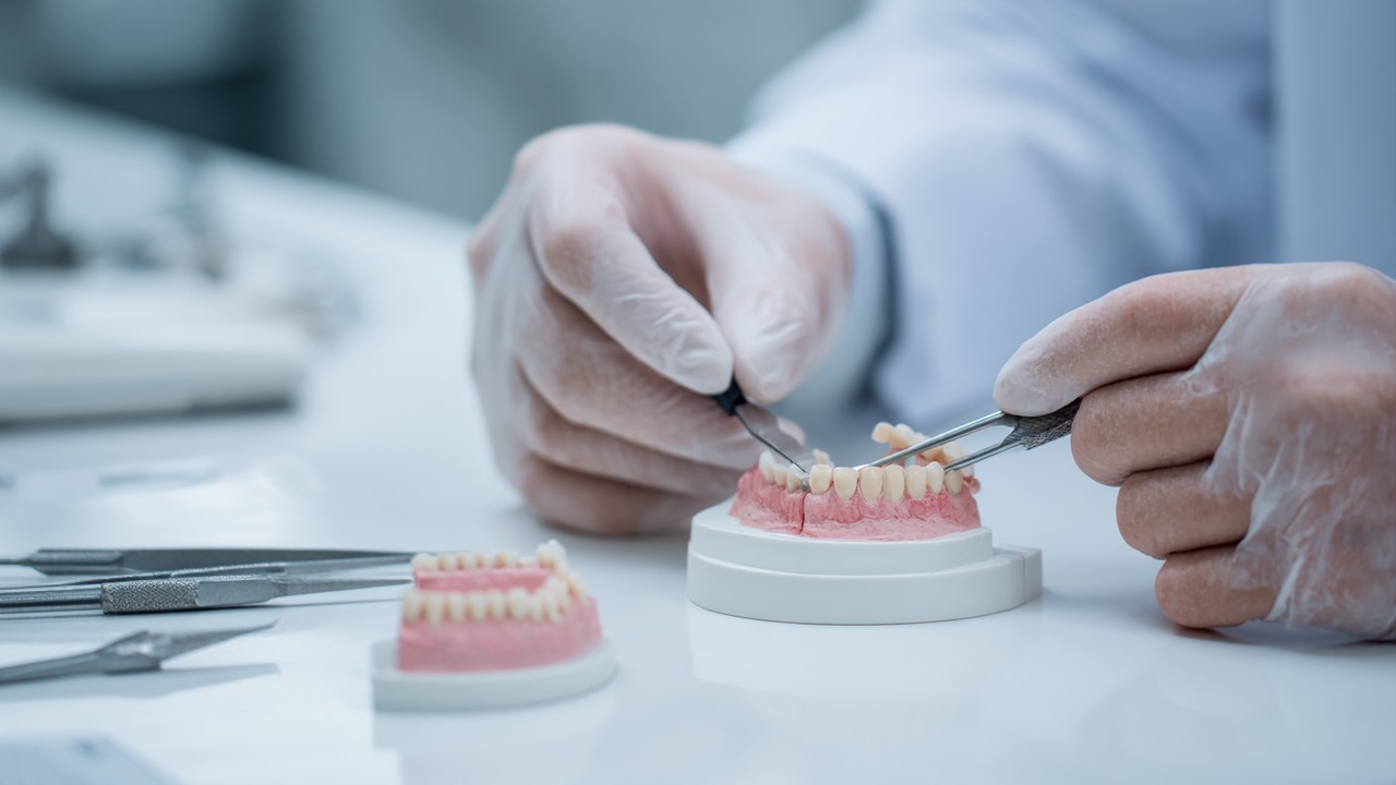 Precyzyjna praca technika dentystycznego przy tworzeniu indywidualnych licówek stomatologicznych w nowoczesnym laboratorium dentystycznym.
